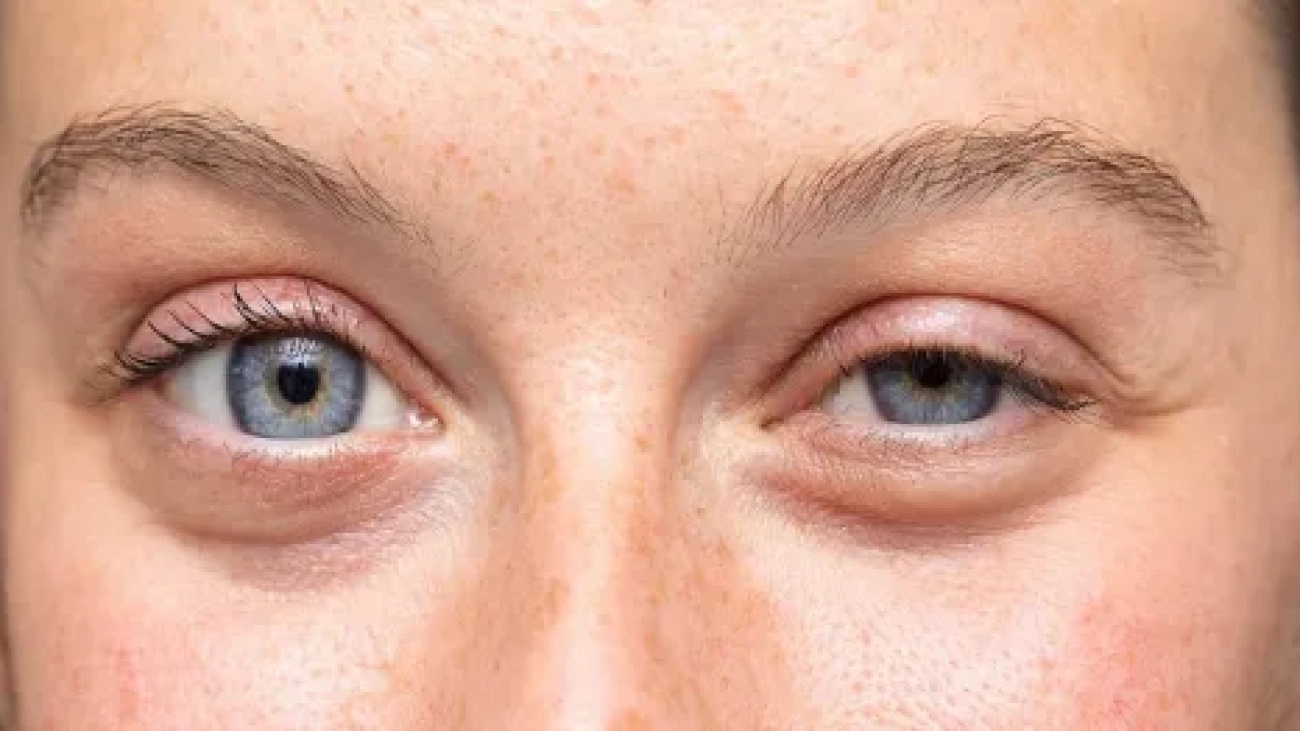 botox-shafafoptic.com