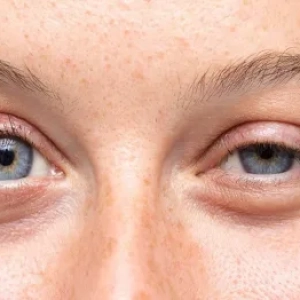 botox-shafafoptic.com