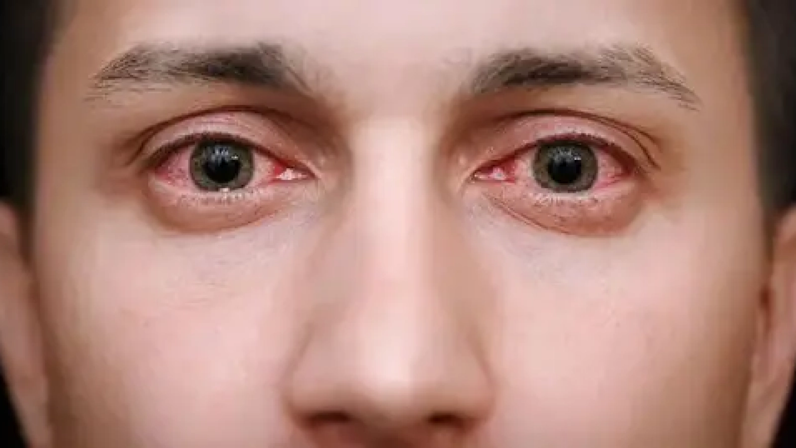 keratitis-shafafoptic.com