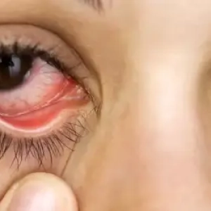 روماتیسم چشمی