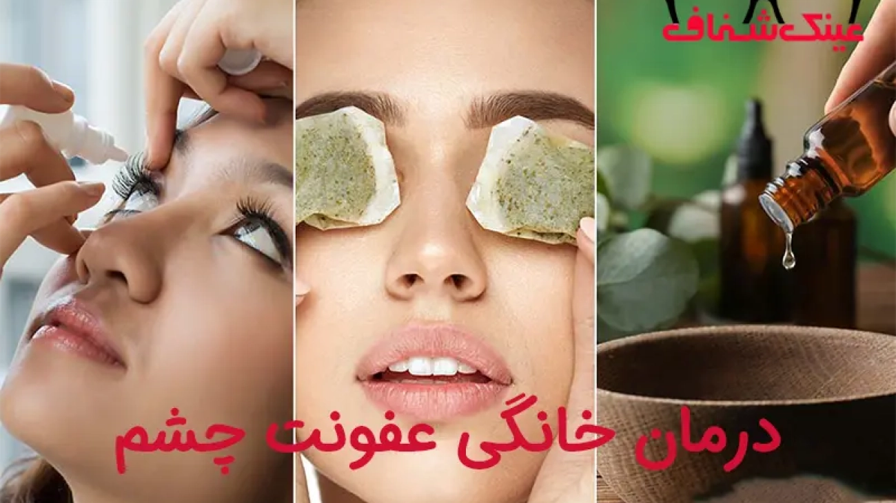 درمان خانگی عفونت چشم
