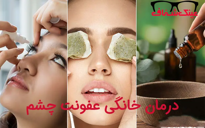 آیا عفونت چشم در خانه درمان پذیر است؟
