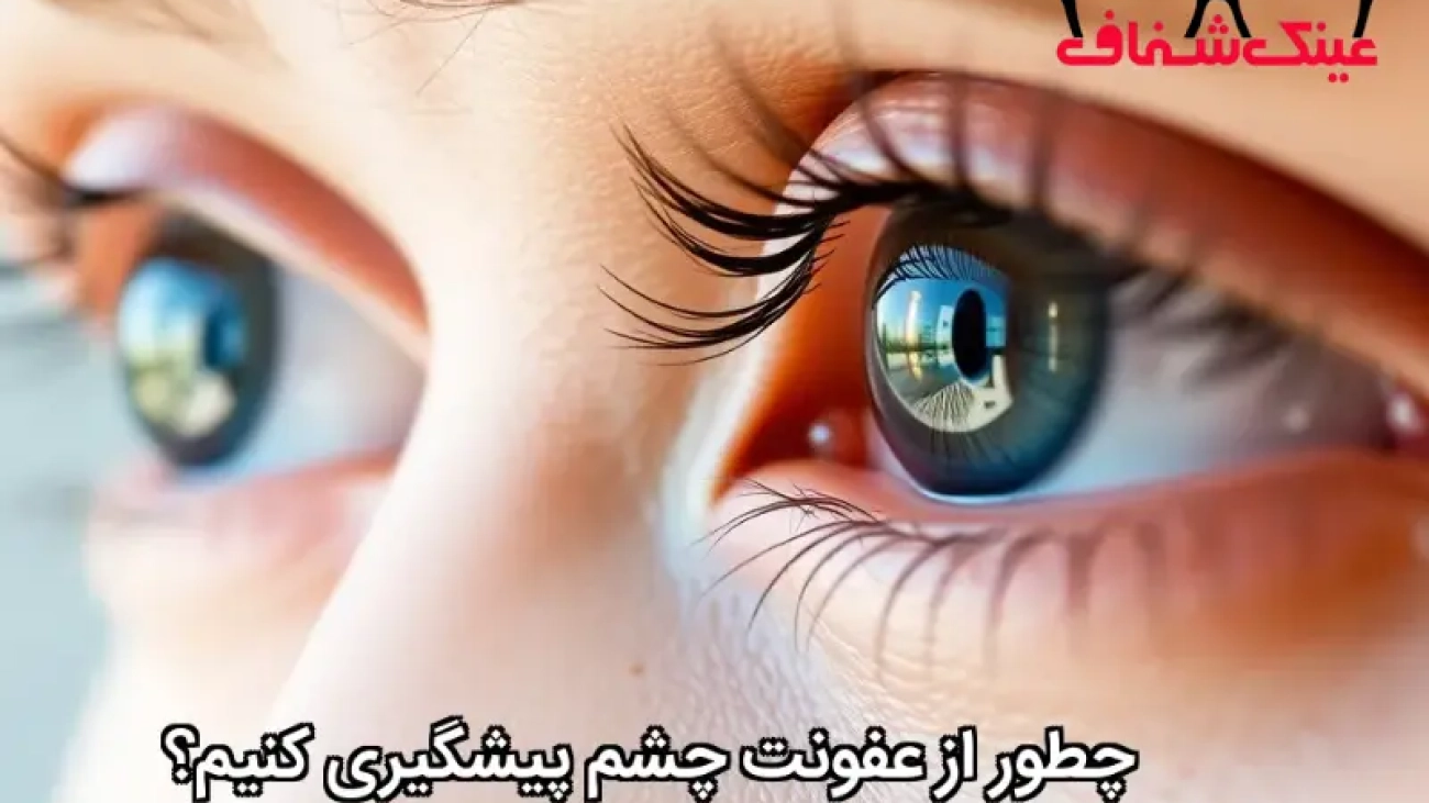 چطور از عفونت چشم پیشگیری کنیم؟