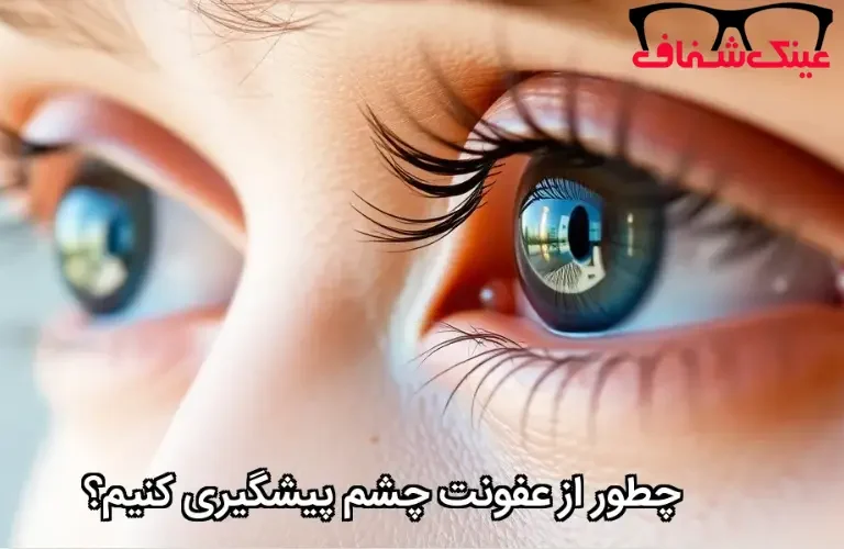 چطور از عفونت چشم پیشگیری کنیم؟