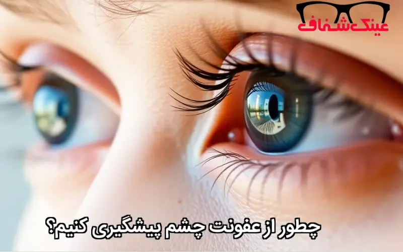 چطور از عفونت چشم پیشگیری کنیم؟