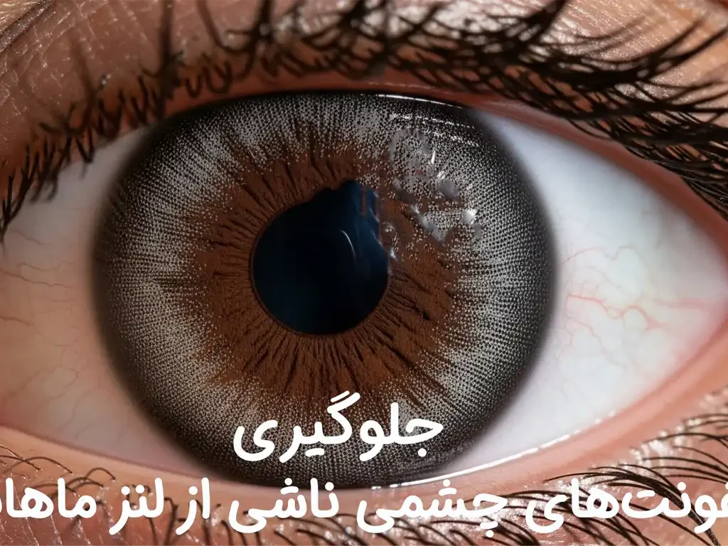 چگونه از عفونت‌های چشمی ناشی از لنز ماهانه جلوگیری کنیم؟