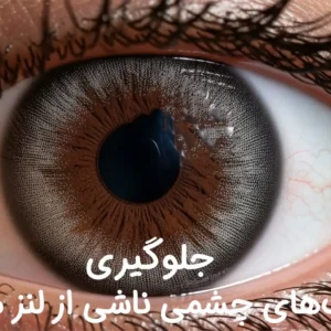 چگونه از عفونت‌های چشمی ناشی از لنز ماهانه جلوگیری کنیم؟