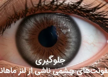 چگونه از عفونت‌های چشمی ناشی از لنز ماهانه جلوگیری کنیم؟
