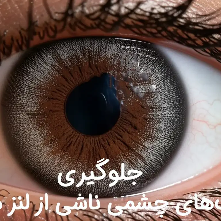 چگونه از عفونت‌های چشمی ناشی از لنز ماهانه جلوگیری کنیم؟