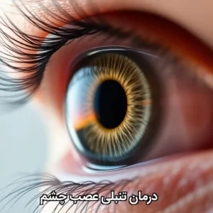درمان تنبلی عصب چشم