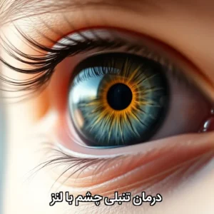 درمان تنبلی چشم با لنز