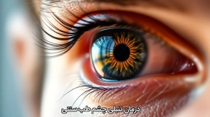 درمان تنبلی چشم طب سنتی