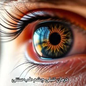 درمان تنبلی چشم طب سنتی
