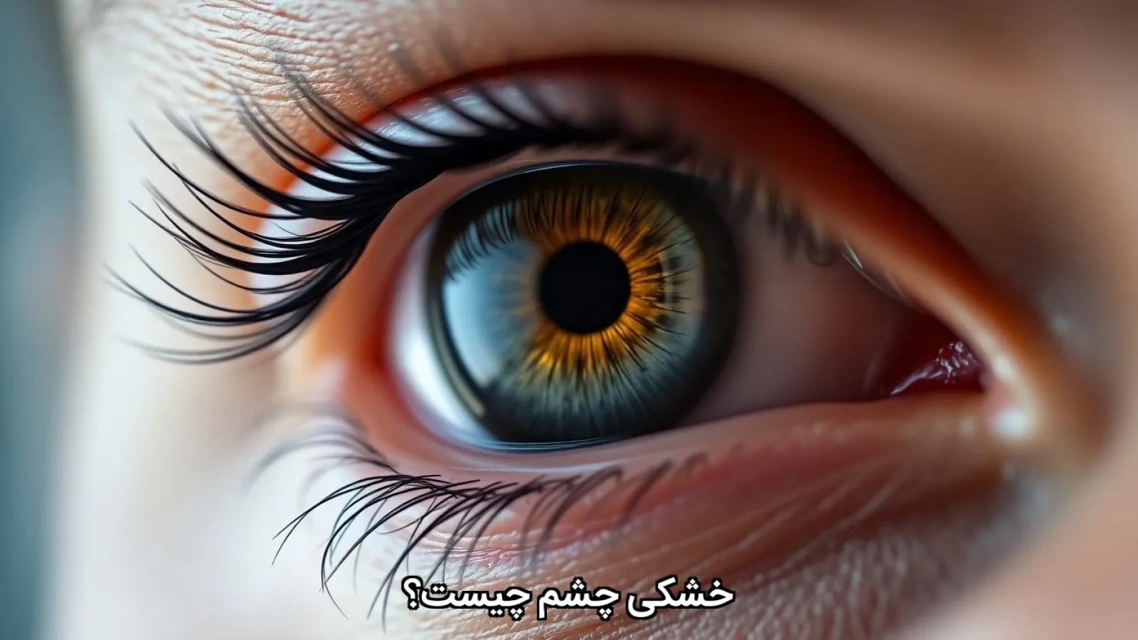 خشکی چشم