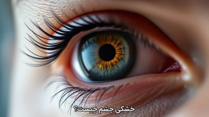 خشکی چشم
