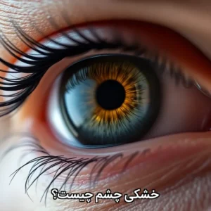 خشکی چشم