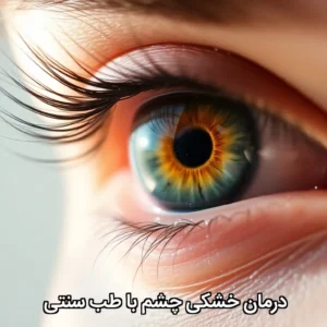 خشکی چشم طی سنتی