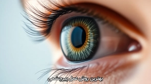 بهترین روش عمل پیرچشمی