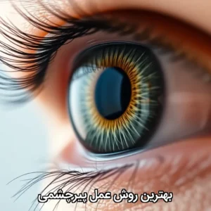 بهترین روش عمل پیرچشمی