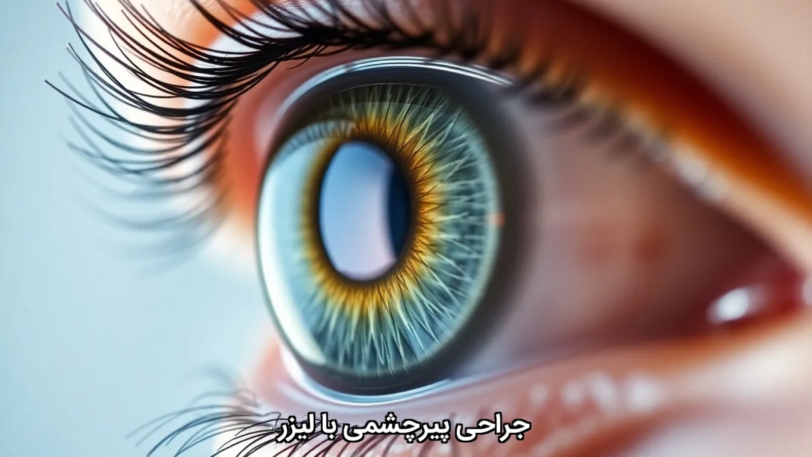 جراحی پیرچشمی با لیزر
