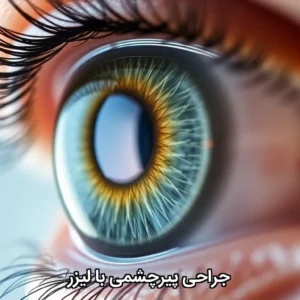 جراحی پیرچشمی با لیزر
