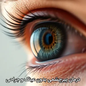 درمان پیرچشمی بدون عینک و جراحی