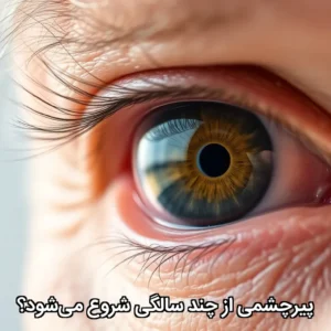 پیرچشمی از چند سالگی شروع می‌شود؟