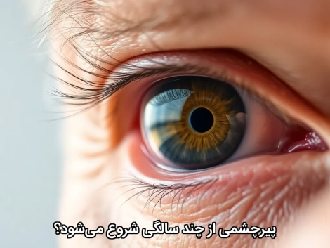 پیرچشمی از چند سالگی شروع می‌شود؟
