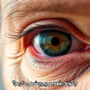 چگونه بفهمیم پیرچشمی داریم؟