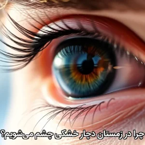 چرا در زمستان دچا خشکی چشم میشویم؟