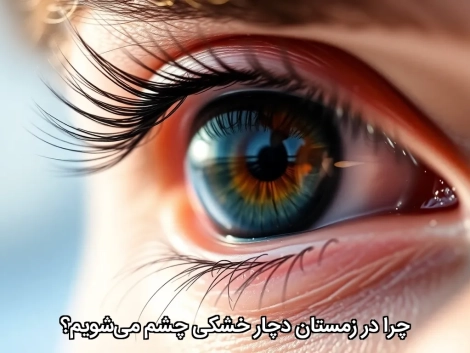 چرا در زمستان دچا خشکی چشم میشویم؟